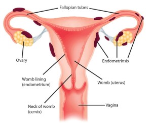 Na snímku normální zdravá děloha