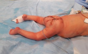 Centrum fetální medicíny ÚPMD Praha